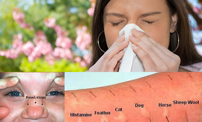 «Αλλεργική Ρινίτιδα: Ένα συχνό πρόβλημα», από την Αικατερίνη Γιώτη - Ωτορινολαρυγγολόγο